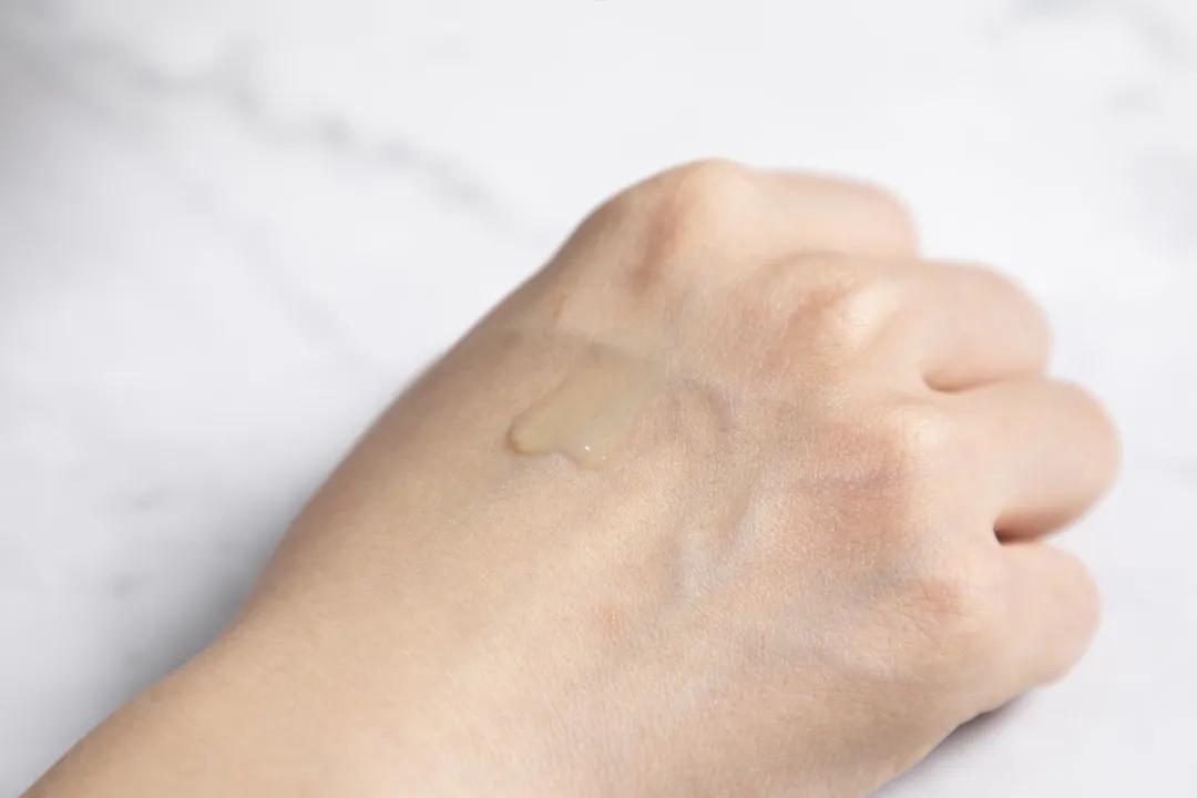 让无数姑娘无从下手的痘印，皮肤科医生有了解决新招