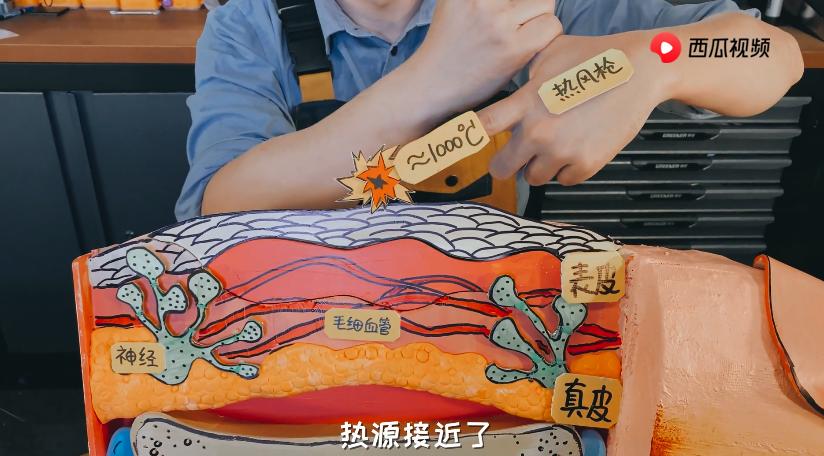 深二度烫伤和浅二度烫伤对比图片,烫伤的泡变暗红色