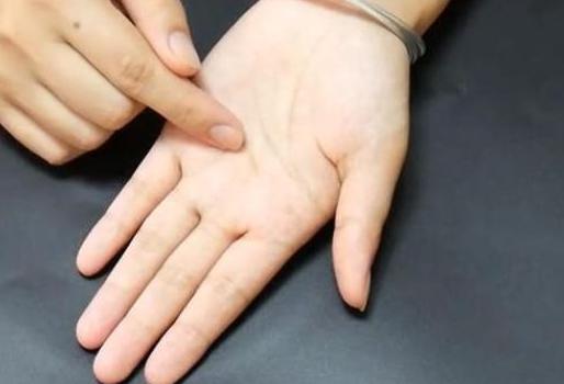 不用针挑刺的方法,怎么用针挑出刺