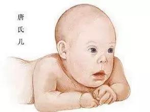 「孕妈百科」准妈妈必看！你有必要知道的产前超声检查！