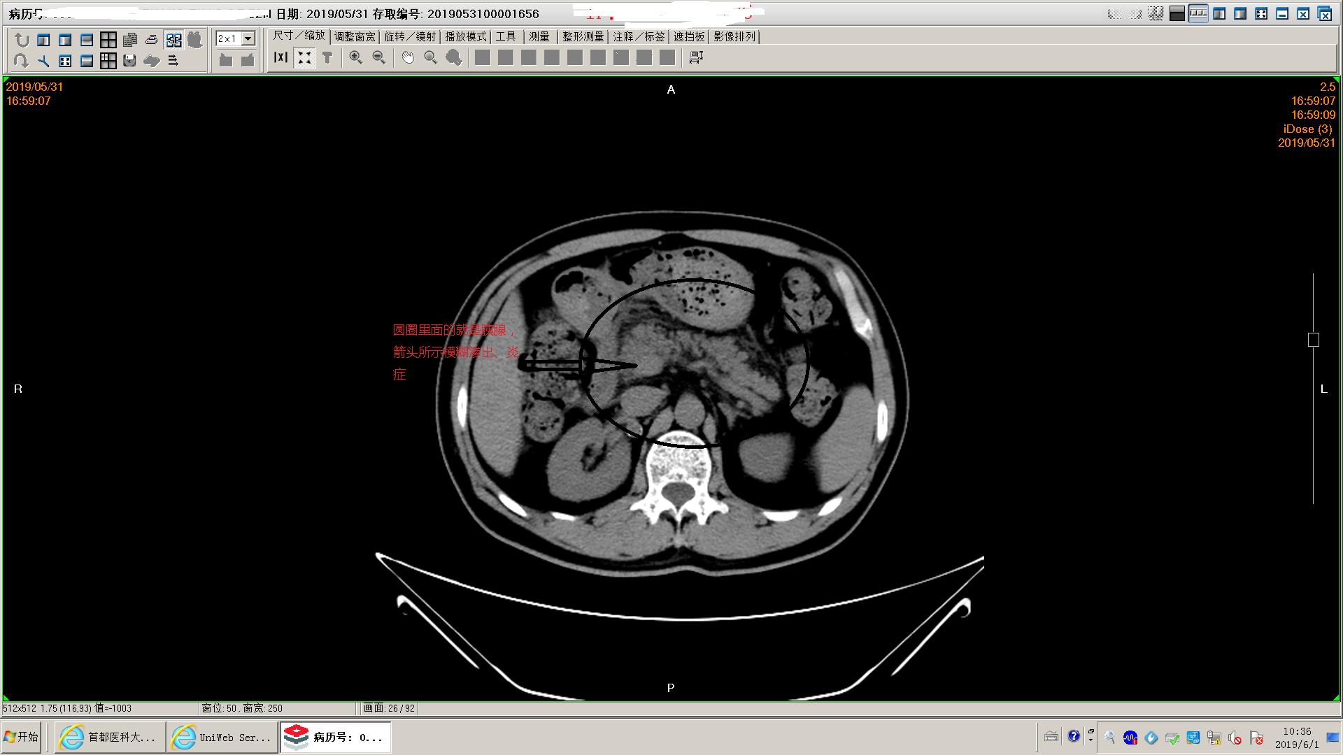 狗得了胰腺炎怎么办,狗得了胰腺炎治疗