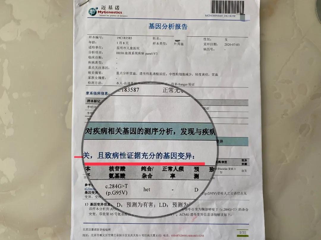 贵州基因突变的小孩,小孩子出生基因变异