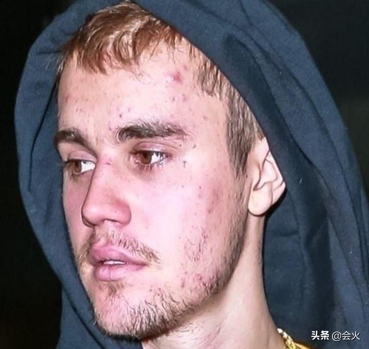 贾斯汀比伯因为哪首歌翻红,贾斯汀比伯给中国捐20万