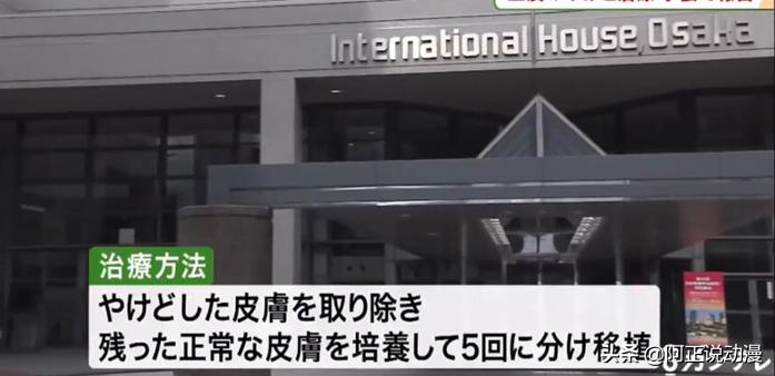 京阿尼纵火案青叶真司,青叶真司纵火犯