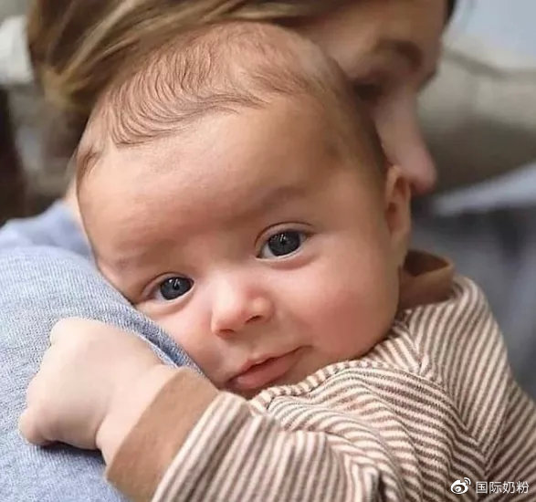 宝宝眼睛红肿流泪是上火啦?错!这些才是主要原因