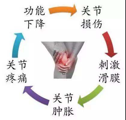 滑膜炎来袭，还有什么可以阻挡？