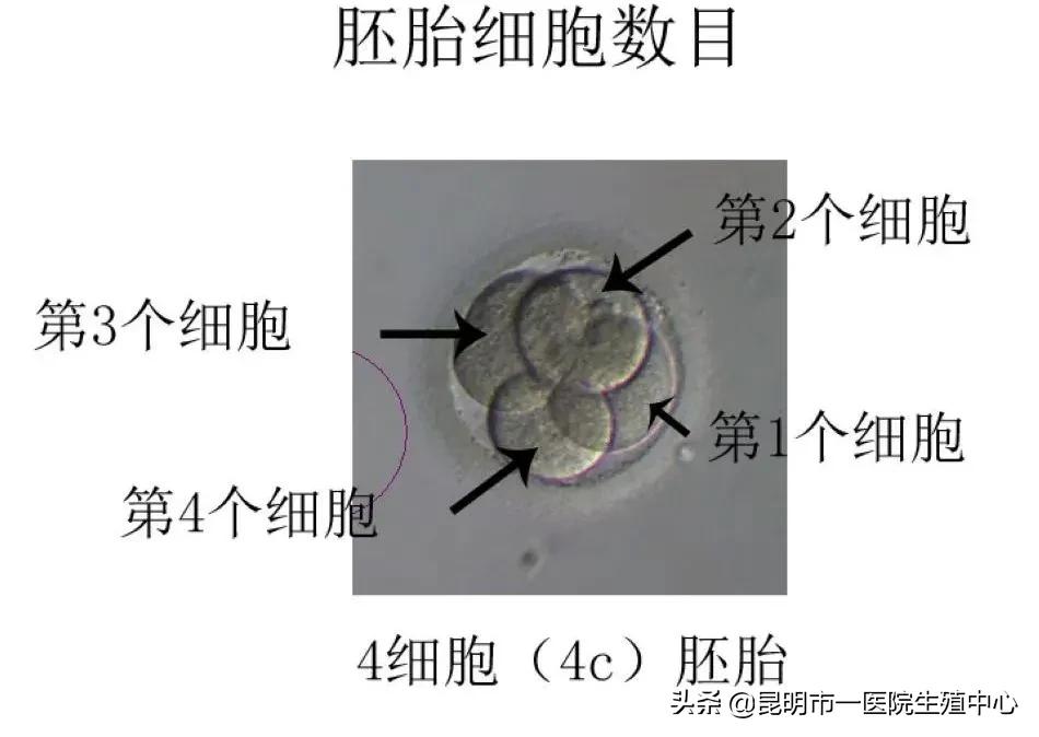 试管小白——“顶流”级别的胚胎长啥样？