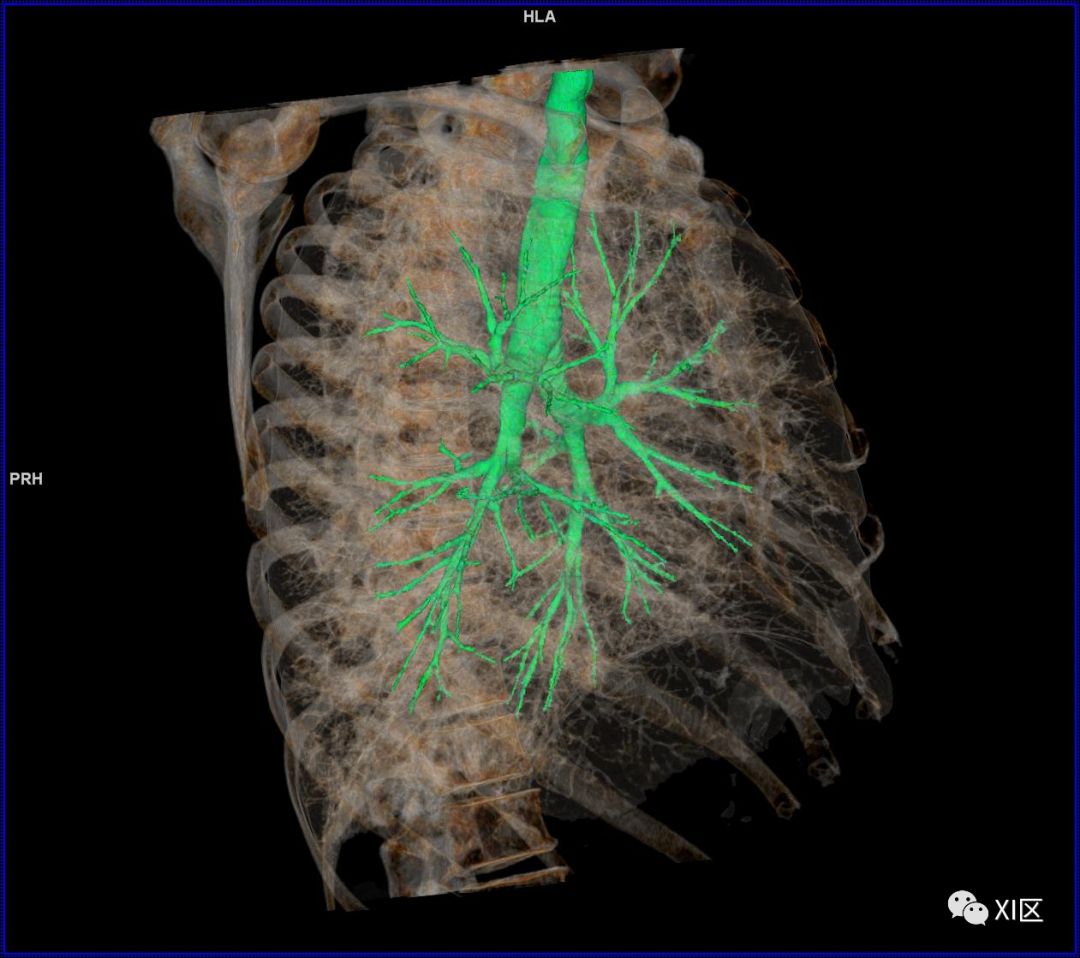 如此详细的肺部影像解剖，有点儿酷！
