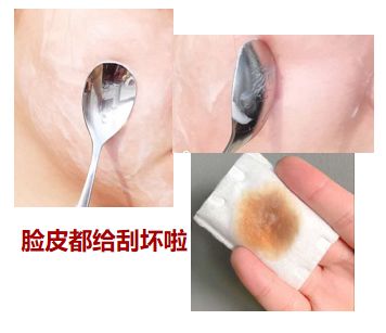 小红书祛痘最火的文章,小红书上教的祛痘方法真的有用吗