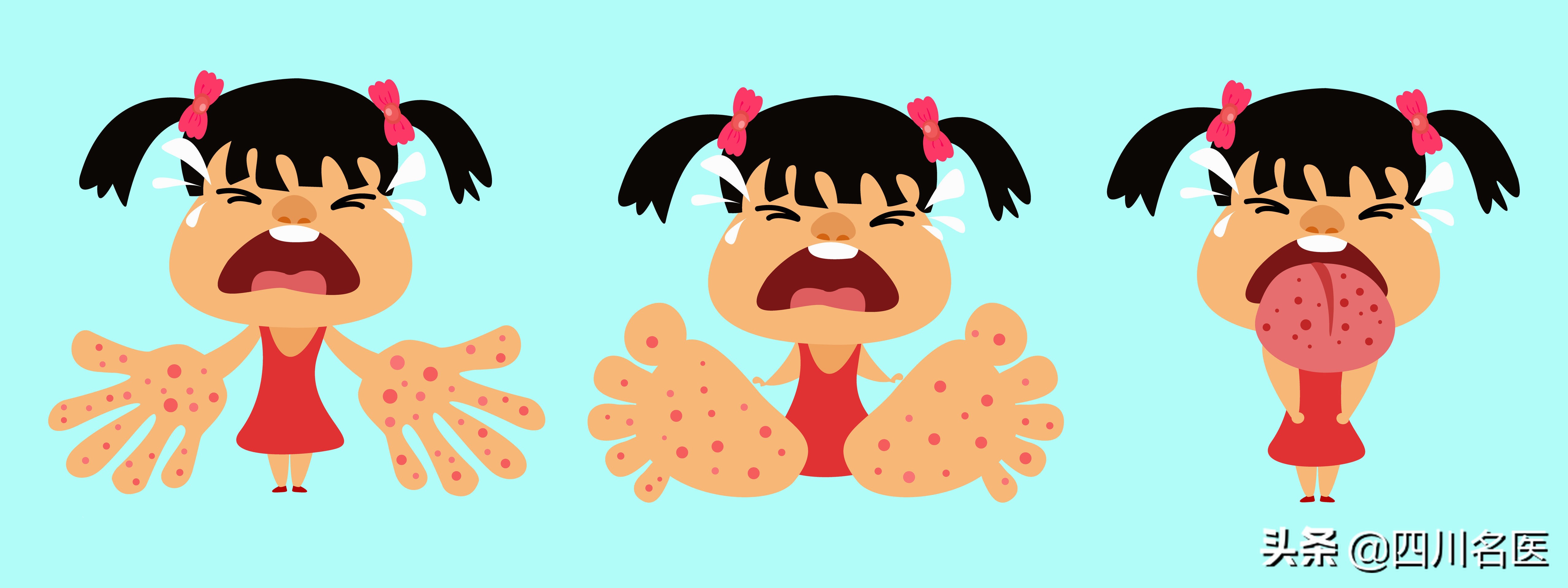 2岁孩子病毒发烧39度反反复复,小孩疱疹一直高烧39以上怎么办