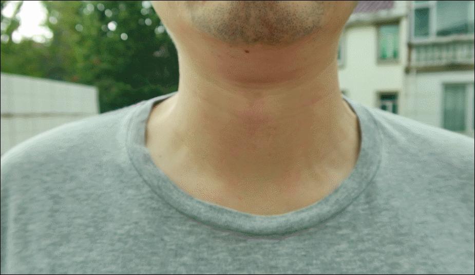 女士胸部减肥后下垂怎么办,减肥后胸部下垂锻炼