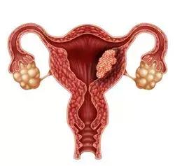 梁雪芳：怕它不来，又怕它乱来！异常子宫出血怎么办？