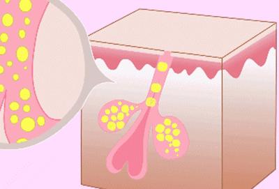 脸上有阳光如何统一肤色,如何解决脸上的光