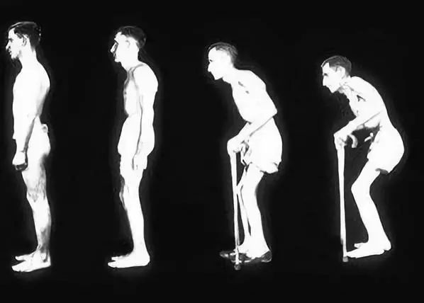 “东方美女”也是病？严重能夺命