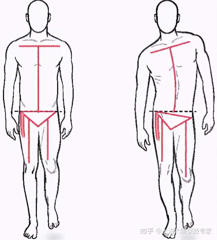 文根矫形,肢体矫形相关知识