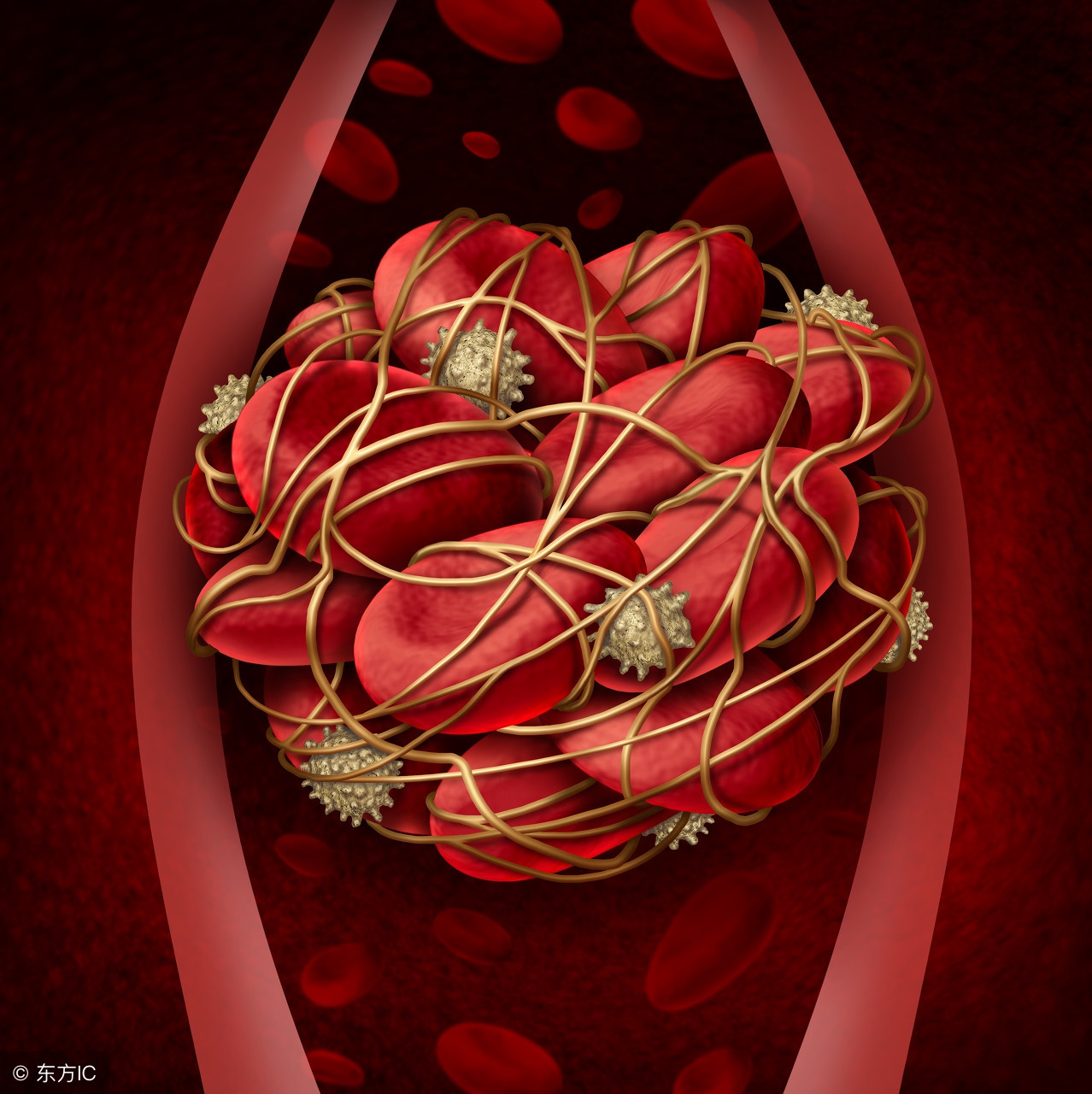 静脉血栓脚肿的对症治疗,深静脉血栓静脉炎脚肿吃什么药好