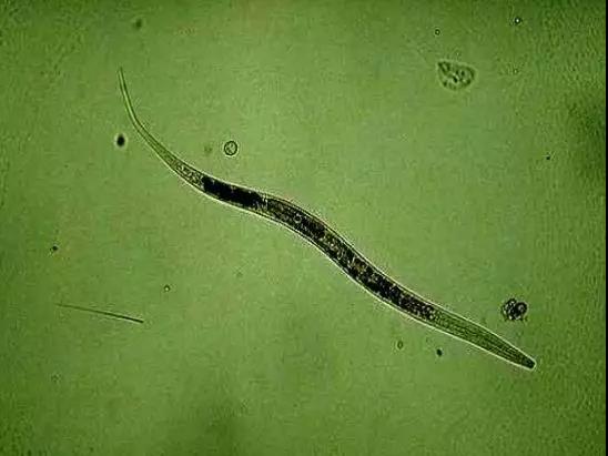 污泥镜检操作方法,污泥检测项目及标准有哪些呢