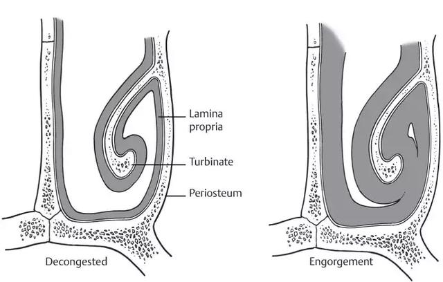 鼻子塞得严重怎么解决呢,鼻子塞住的快速缓解方式