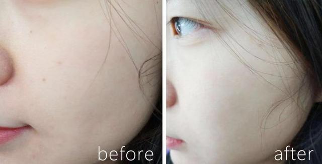 377是精华液吗,377是什么护肤成分怎么用最好