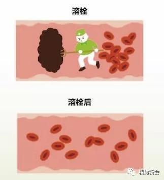 温县人民医院卒中中心,温县第二人民医院视频