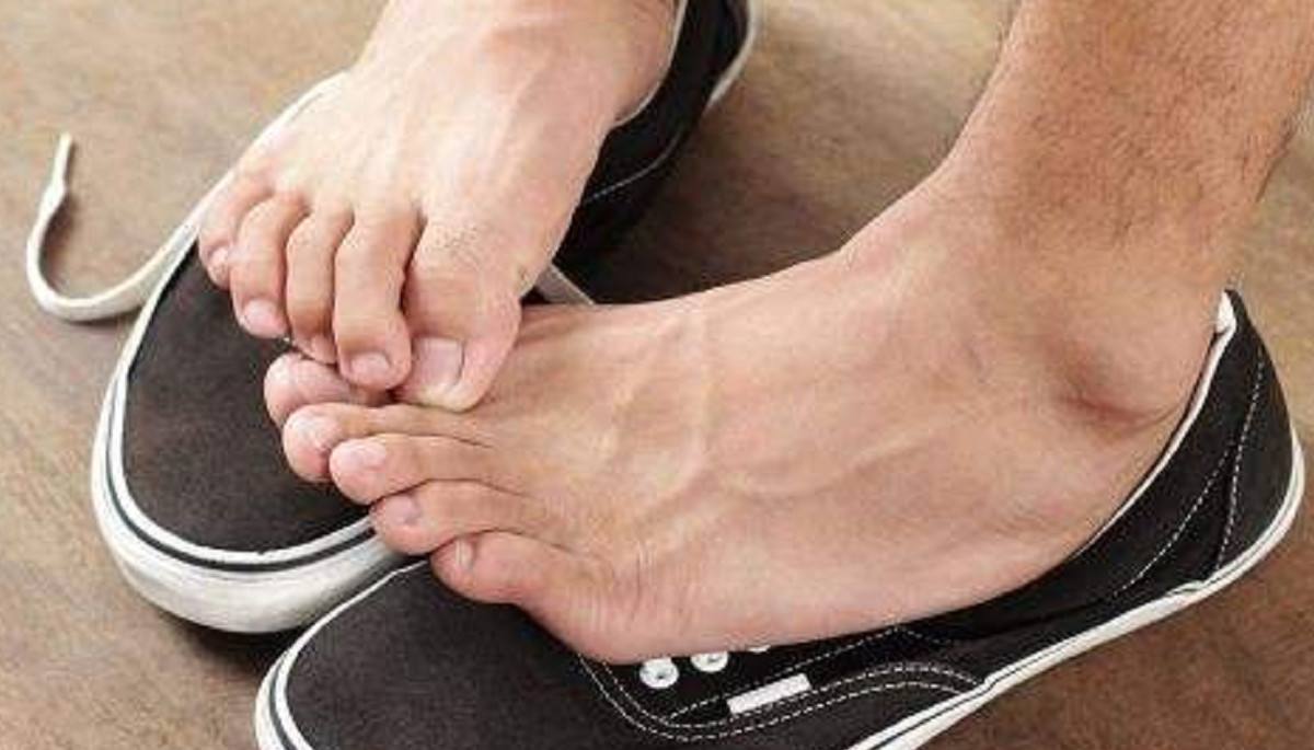 一到夏季脚气犯了怎么办,香港脚教你一招解决脚气