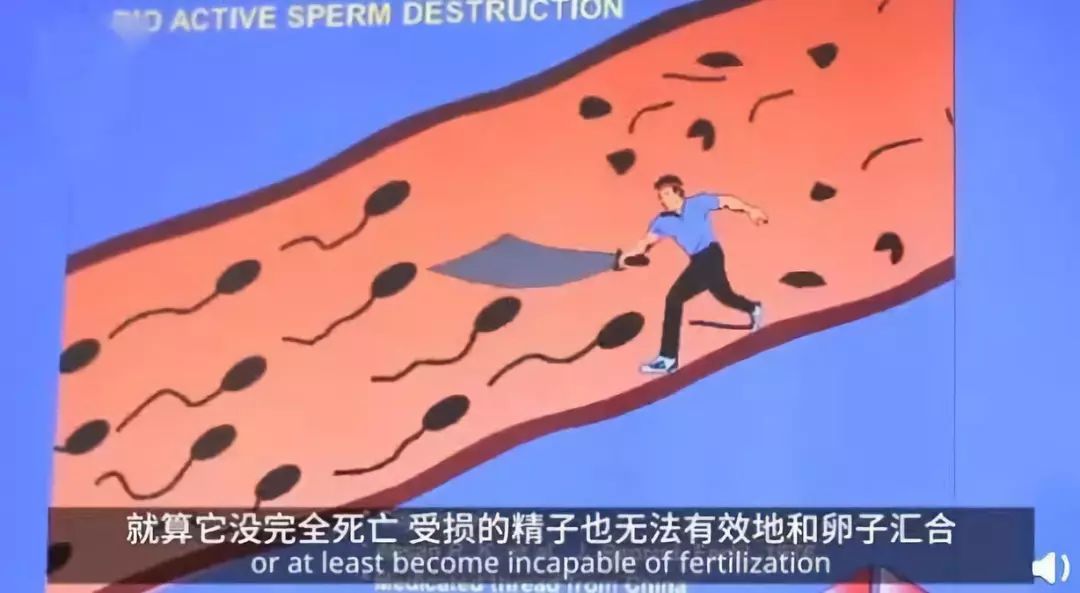 男性避孕针打了想怀孕怎么办,男性避孕针13年一针去哪打