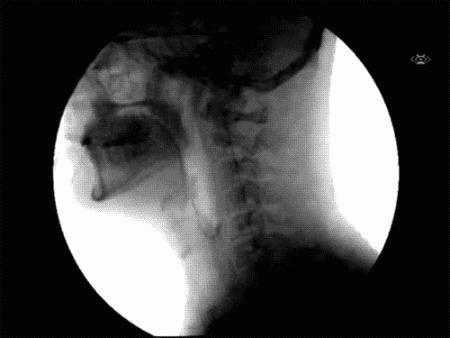 科普张姿势动图：感觉自己姿势又涨了100点