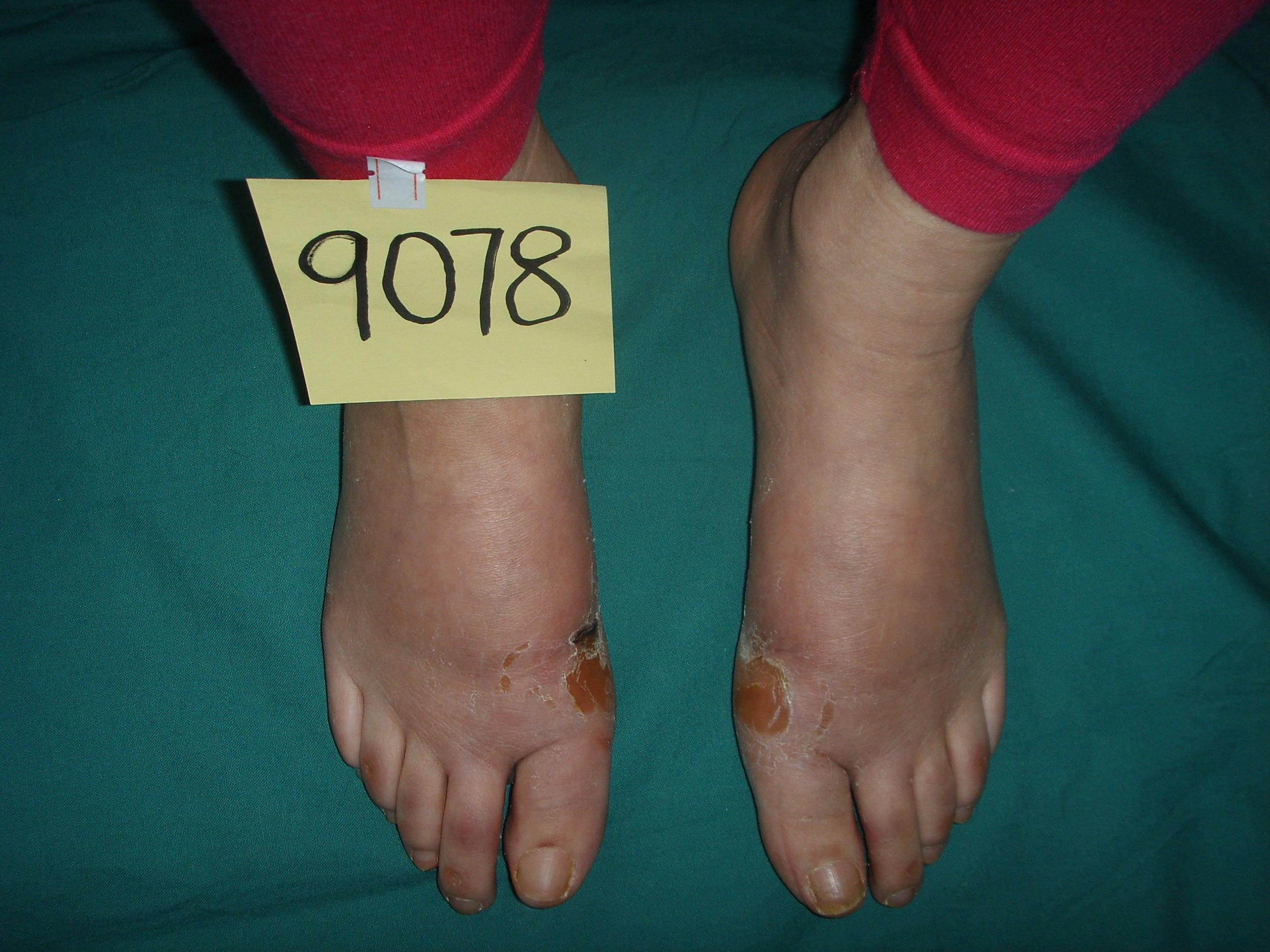 30岁的女人大脚骨,脚大的女生想穿小皮鞋