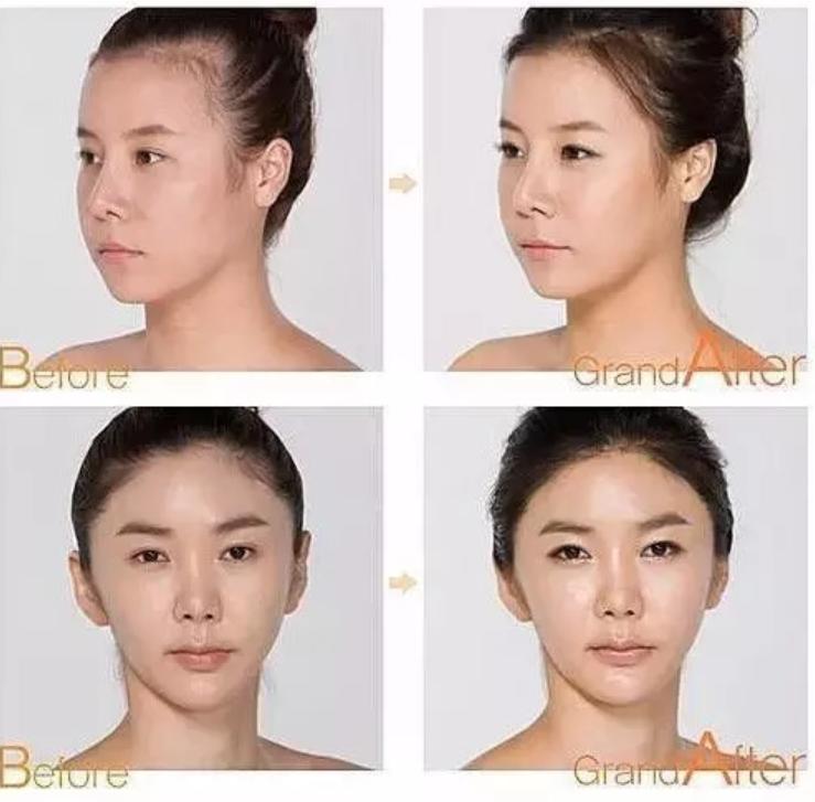 发际线到底怎样才好看,为什么有人的发际线好看