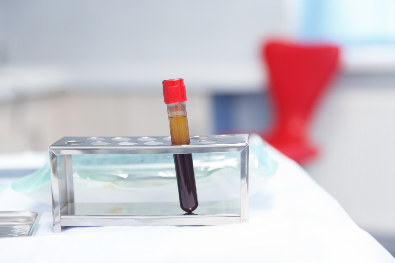 血清治疗新型冠状病毒,新冠特免血浆治疗是真的吗