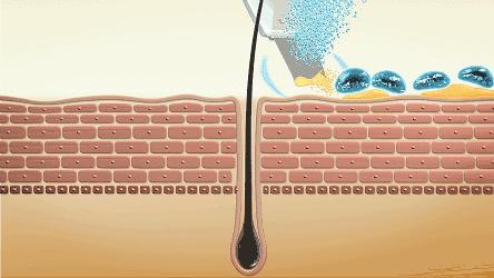 毛孔堵塞是病吗,皮肤暗沉毛孔堵塞怎么办