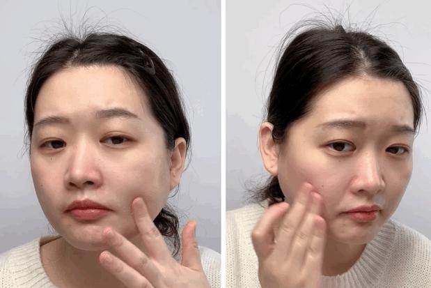 有黑头和没黑头有什么区别,没有长过黑头却长黑头怎么办