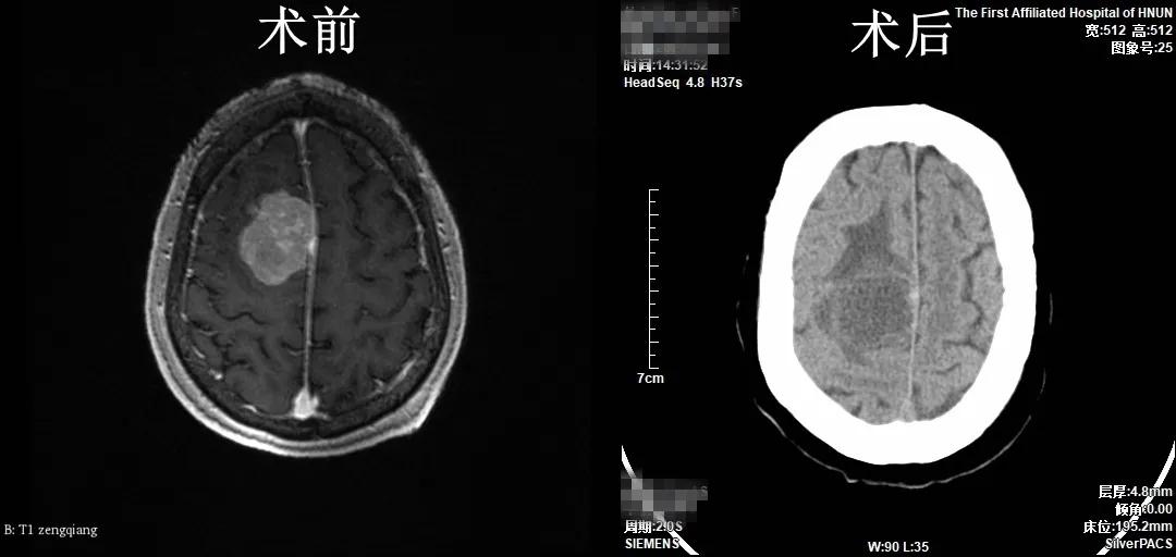 病例报道写作书籍,病例在线解读
