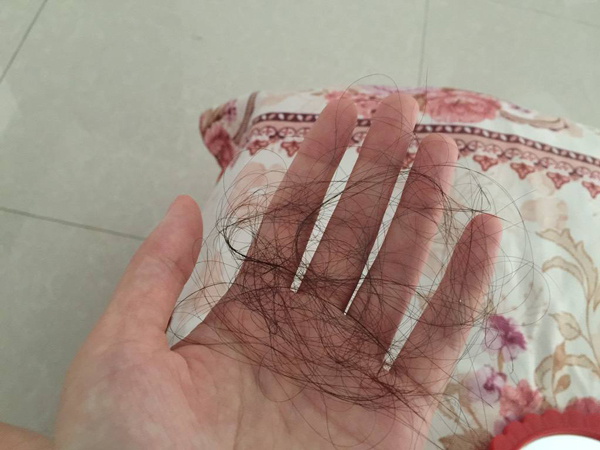 如何应对女人掉头发,女生掉头发严重如何防护