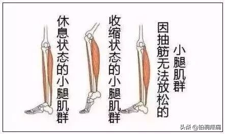 腿脚抽筋跟缺钙有关系吗,腿脚抽筋严重缺钙怎么补