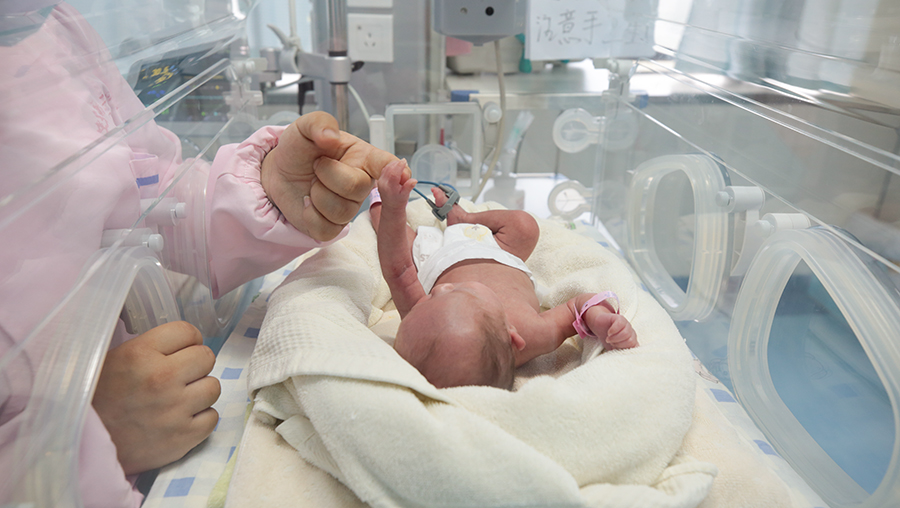 多学科协作成功救治一名危重患者,市二院成功救治30周三胞胎早产儿