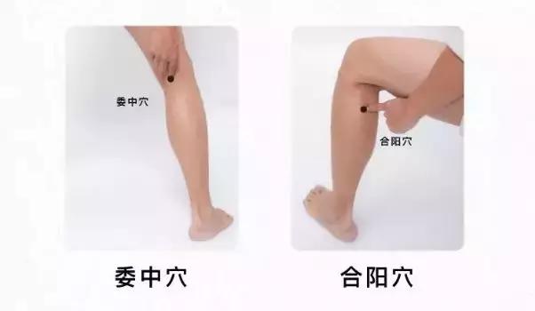 湿疹跟身体湿气重有关系吗,湿疹是因为体内湿气重造成的吗