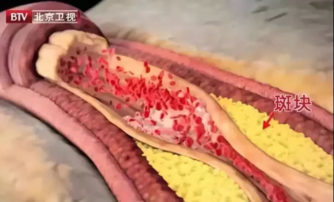 小熊饼干里面有致癌物吗,哪五种饼干查出有致癌物质