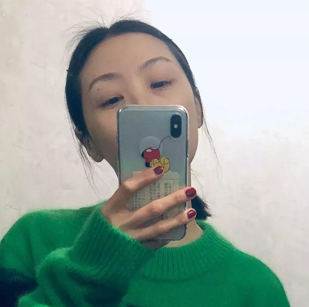 雪莉为什么会变黑,雪莉的照片为什么会越来越模糊