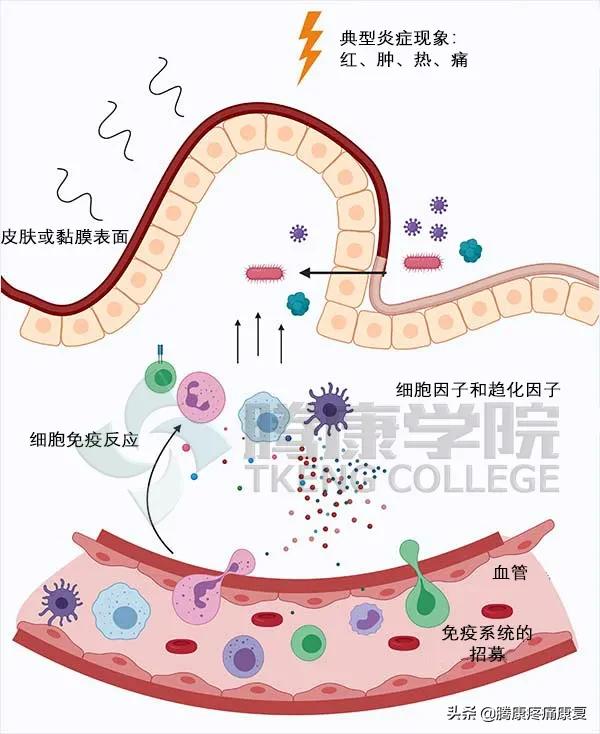 理疗对骨性关节炎有什么作用,骨性关节炎炎症怎么消除