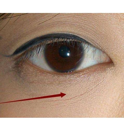 脸上干纹细纹多怎么办,怎样改善脸上的干纹和细纹