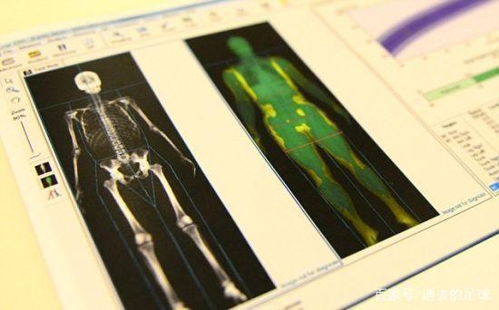 奥运金牌第一是谁,奥运金牌含金量科普