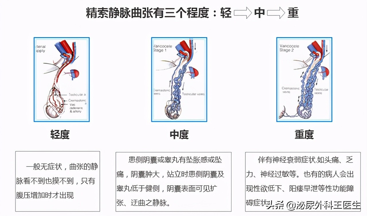影响精子质量都有哪些因素,精子质量差如何提高精子质量