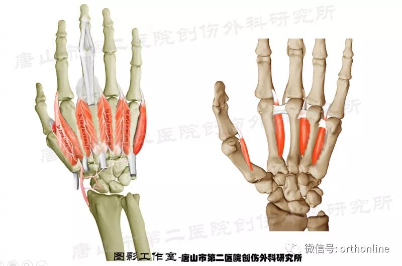手部肌腱不完全断裂能完全复原吗,手部屈指肌腱损伤最难处理的部位