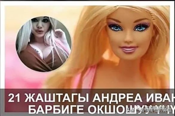 20次整容成功的女人,22岁女人做20次丰唇手术