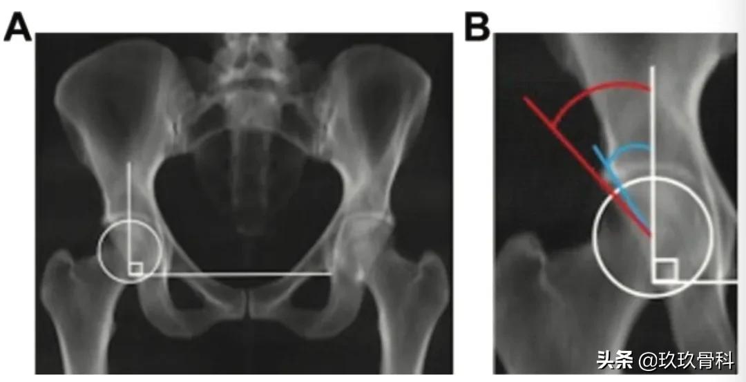 髋膝关节文献精译荟萃