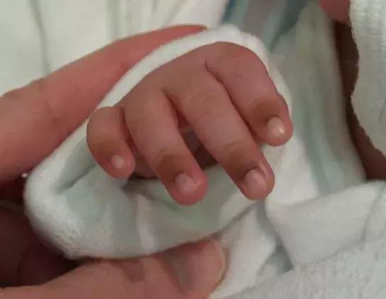 手指节皮肤发黑怎么回事啊,奇怪的手指图片