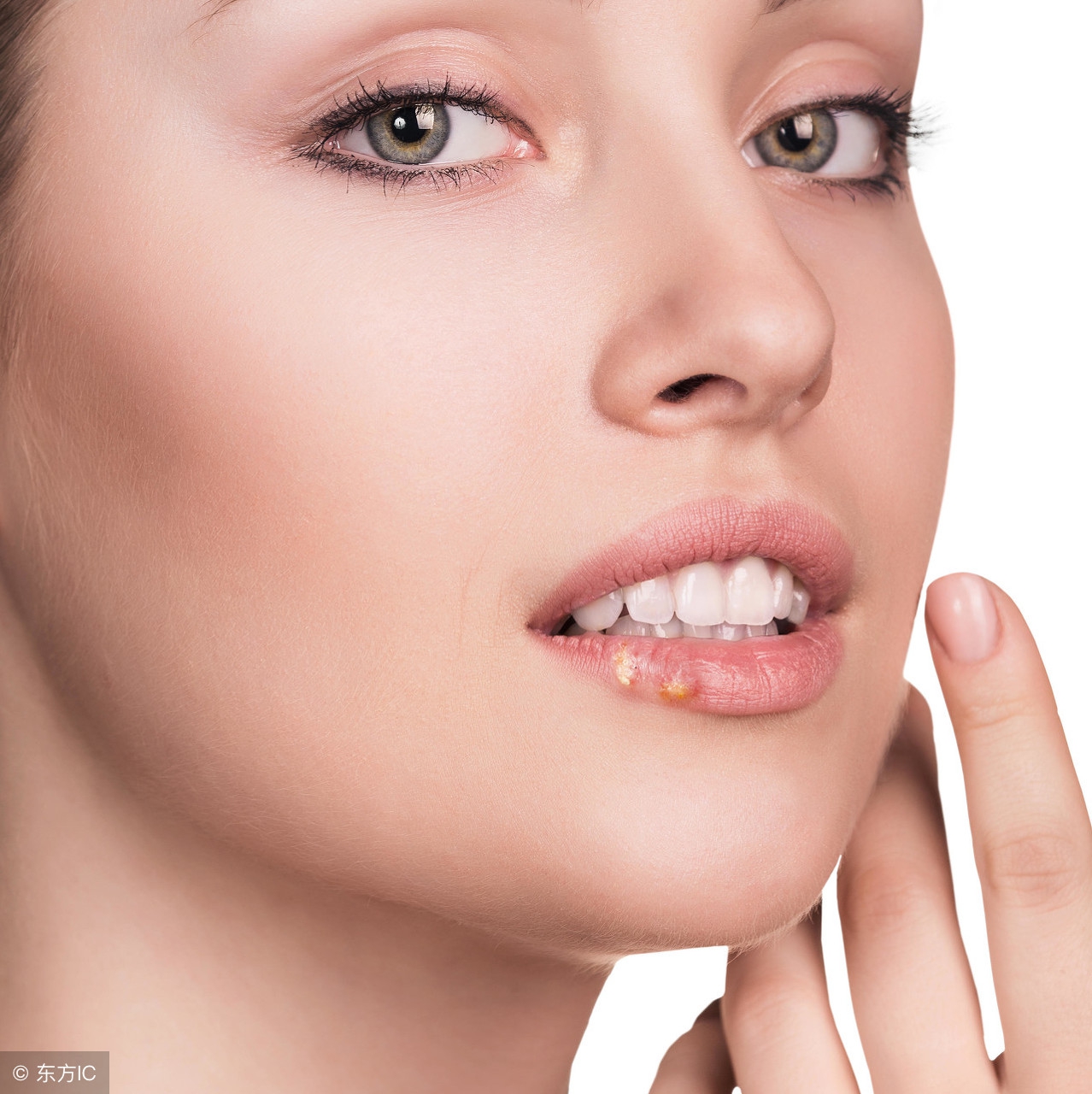 生殖器附近长水泡,生殖器包皮上长水泡