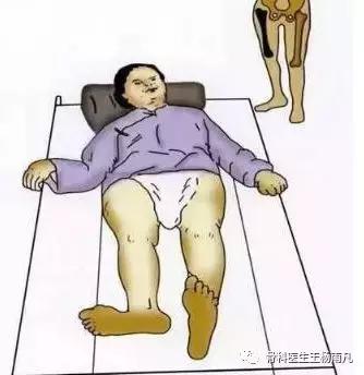 鬼门关前一道坎（上篇）：家里老人滑到了，胯部骨折了严重吗？