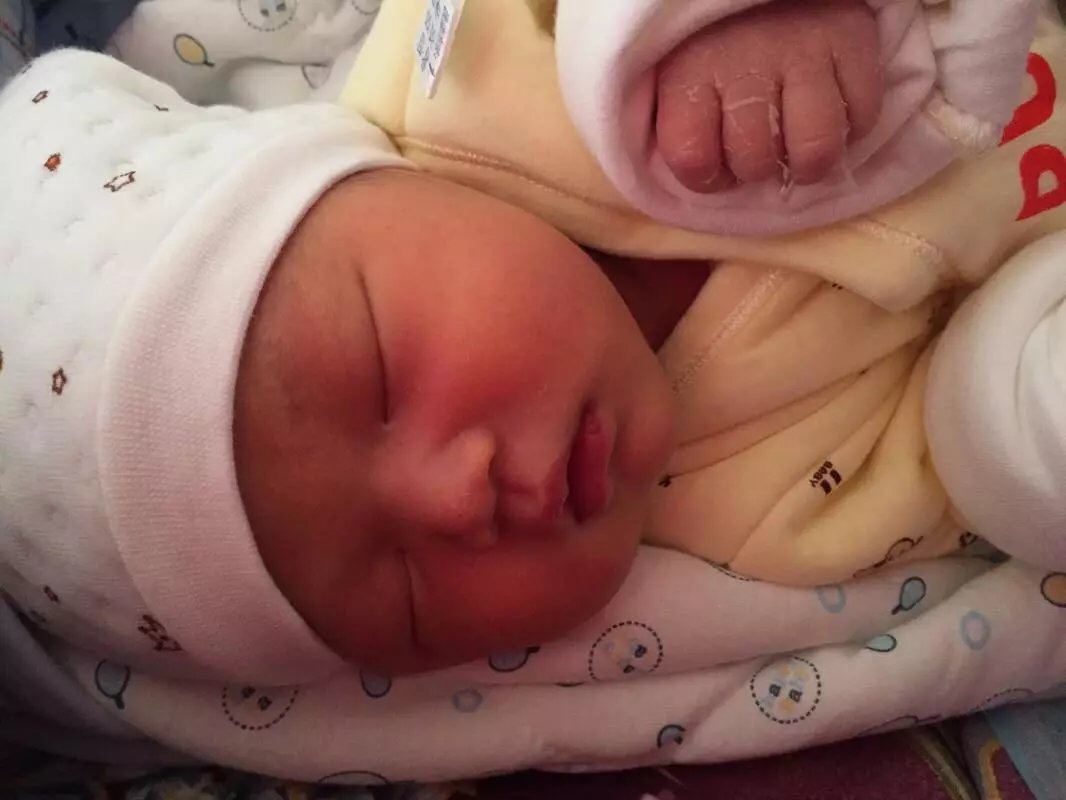 新生儿特殊生理现象照片,新生儿的正常生理现象